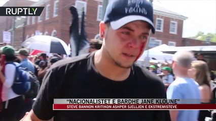 “Nacionalistët e bardhë janë klounë” - News, Lajme - Vizion Plus