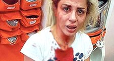 İstanbul'un Göbeğinde Genç Kadını Taciz Edip Öldüresiye Dövdüler