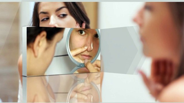 Blackheads removal tips | how to remove blackheads on your face permanently