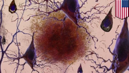 MIT researchers reverse memory loss in mice with Alzheimer's