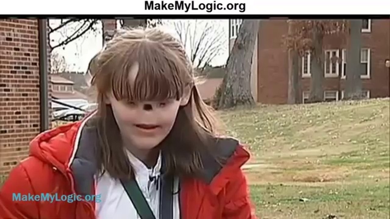 بغیر آنکھ اور ناک والی لڑکی۔۔استغفراللھ