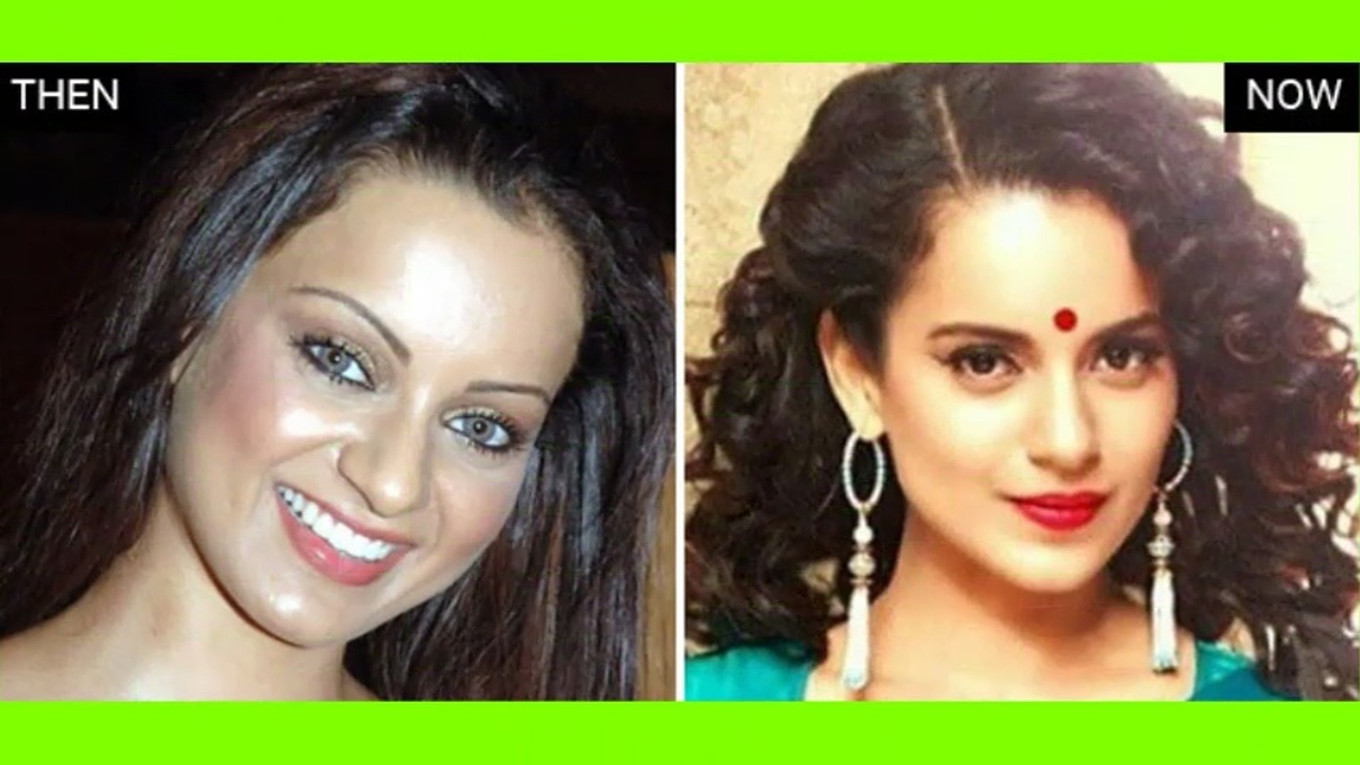 Plastic surgery before and after