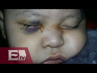 Denuncian negligencia del IMSS por extirpar ojo de bebé en Sonora / Titulares de la tarde