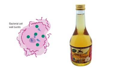 Impetigo Treatment At Home With Apple Cider Vinegar To Get Rid Overnight Fast