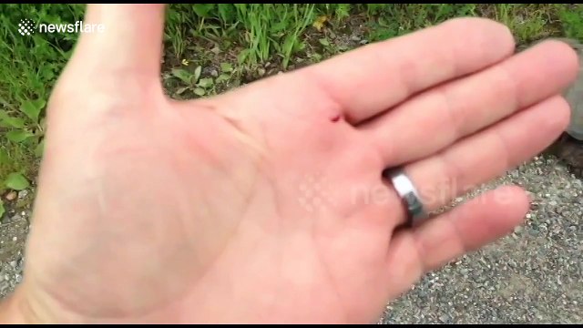 Snapping turtle bites man's hand