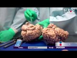 Lesiones cerebrales en casi todos los jugadores de NFL | Noticias con Yuri