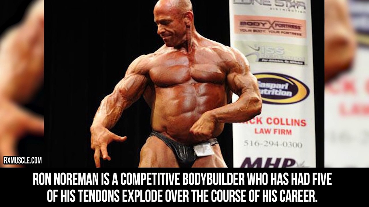 10 Bodybuilders Whose Muscles Exploded