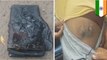 Xiaomi Redmi Note meledak dalam saku seorang pria - TomoNews