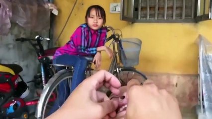 Cận cảnh màn nhổ răng khiến các nha sĩ phải “xin quỳ”