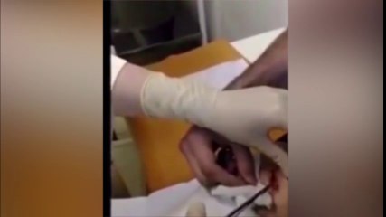 Nữ y tá hoảng hồn khi tìm thấy vật thể lạ trong bụng bạn trai