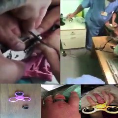 fidget spinner danger kor kids