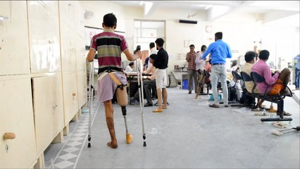 "هذا الصباح"-طابعات ثلاثية تسهل إنتاج الأطراف الصناعية