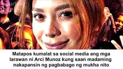 Arci Munoz matapang na sinagot ang retoke issue: "So, ano ba?"