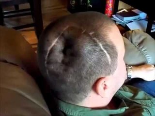 Incroyable..cet homme capable de gonfler sa crane !!