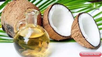 Hair Fall Cantrol Tips in Hindi / बालों के झड़ने से रोकने के घरेलू उपाए