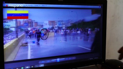 El joven que perdió un riñón en las protestas de Caracas