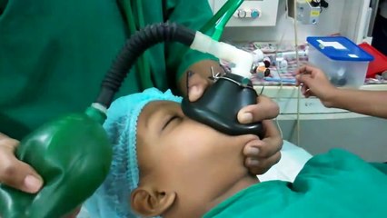 Adenoideo anestesia Dr. para amígdala Cirugía-intubación paulose frcs ent