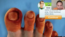Ingrown toenail infected home operation Gross 2016