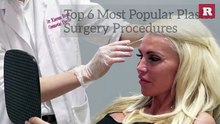 unbelievable change after plastic surgery