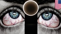Sakit mata Gerhana; warga mengalami gejala sakit mata setelah melihat gerhana secara langsung - TomoNews