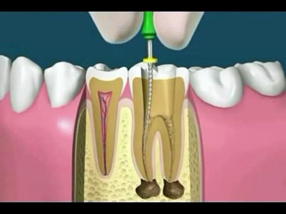 RCT & CROWN ANIMATION