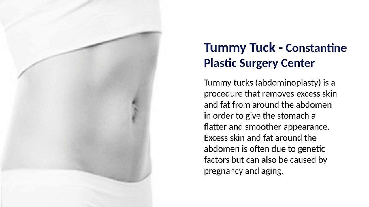 Tummy_Tuck_-_Constantine_Plastic_Surgery_Center (1)