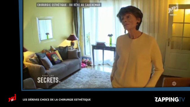 Chirurgie esthétique : Une patiente défigurée après des injections au visage (vidéo)