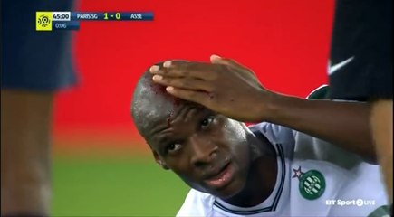 Presnel Kimpembe Horror Foul HD - Paris SG 1-0 St Etienne 25.08.2017