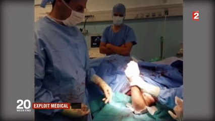 Voici la seule photo de la première réimplantation de bras en France faites à Grenoble - Regardez