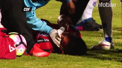 Ce footballeur se sacrifie en utilisant sa tête et fini avec plusieurs fractures au visage