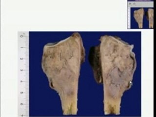Bones - MedicaLook Human Anatomy