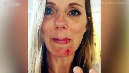 Geri Horner kedisini saldırısına uğradı