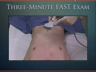 ULTRASOUND VIDEO 6-How-to-perform-FAST-exam