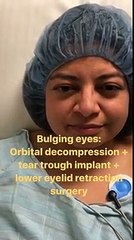 Graves Disease Treatment