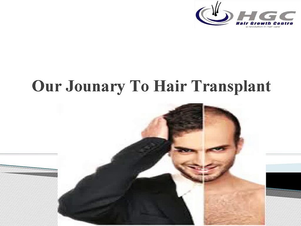 Our_Jounary_To_Hair_Transplant