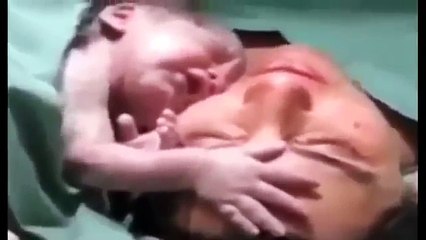 الفيديو الكامل للطفل الذي لا يريد ترك أمه بعد ولادته ويتمسك بها (2)