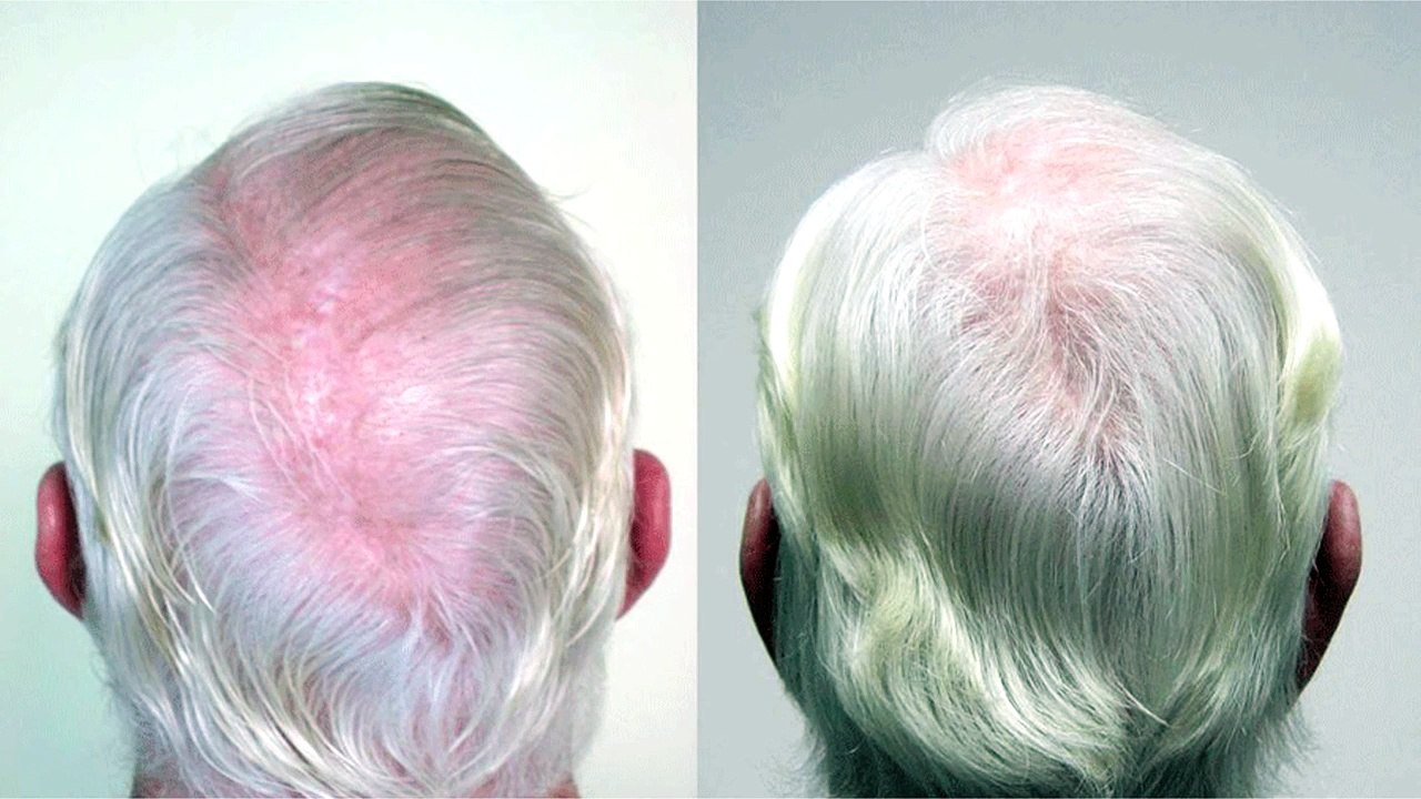 Ancient Hair Secrets – Natural Hair Growth Products