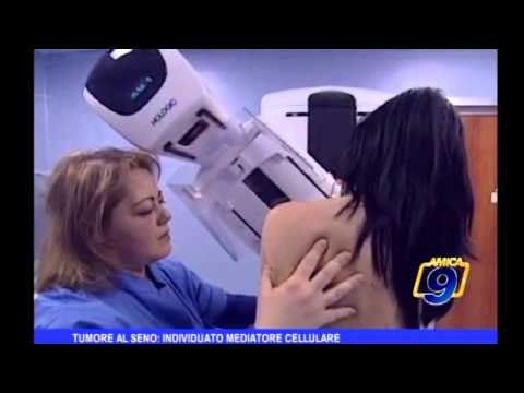 Pensa alla Salute | Tumore al seno individuato mediatore cellulare