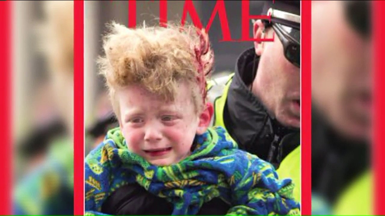 Boy With Rare Disease Lands Part in Movie, Finds Bone Marrow Donor