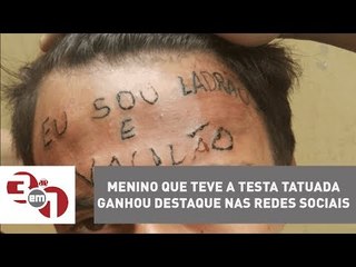 Menino que teve a testa tatuada por dois agressores ganhou destaque nas redes sociais