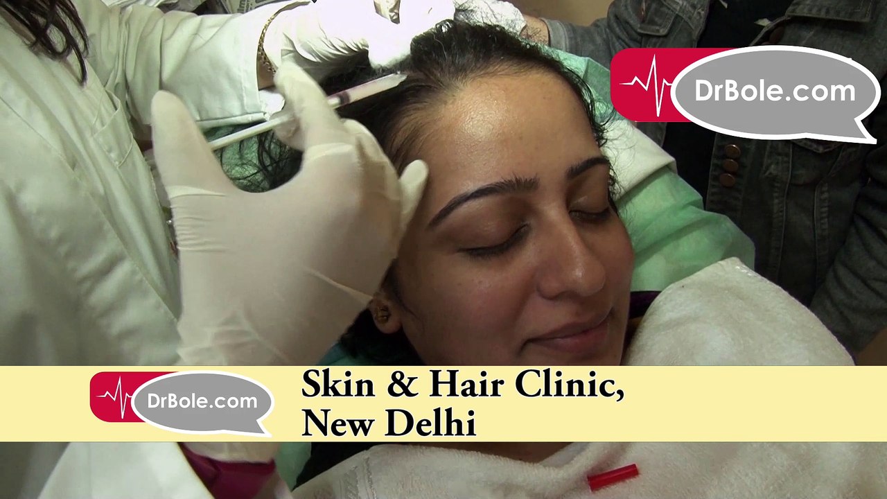 PRP Hairfall Technique_Dr. Deepali Bhardwaj_Skin & Hair Specialist_Skin & Hair Clinic, New Delhi_DrBole.com
