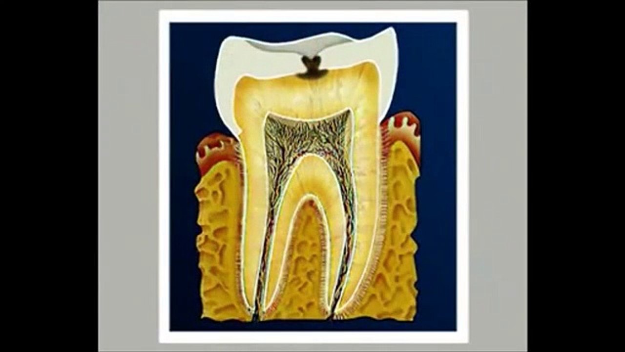 Le traitement des bases de chaire parodontite endodontie