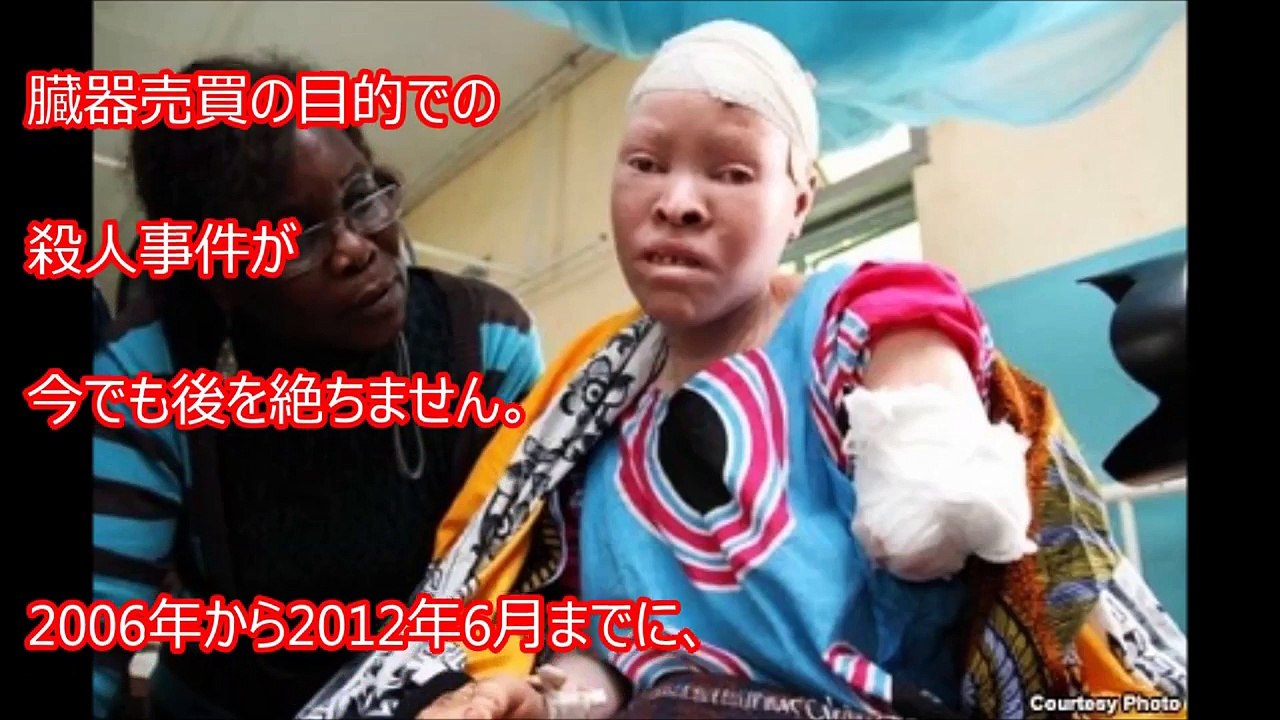 【奇病】美しく神秘的と言われる奇病たち 日本の歴史上の人物、�