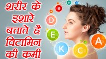 Body signs indicate Vitamin deficiencies | शरीर के संकेत बताते हैं विटामिन की कमी | Boldsky