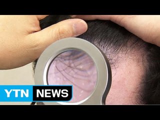 3주 만에 머리카락이...원형탈모 새 치료제 기대 / YTN