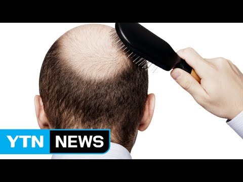탈모 치료 길 열리나...모발 가늘어지는 원인 규명 / YTN
