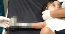 İki İlden Korkunç Haber! İki Minik Çocuk, Ellerini Kıyma Makinesine Kaptırdı