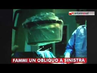 TG 21.10.14 Quando il venditore di pacemaker diventa anche chirurgo