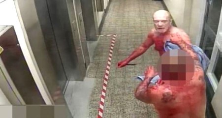 Uyandığında İnternetten Tanıştığı Kişi Boğazını Kesiyordu