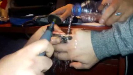 Parmaklarını Yüzüğe Sıkıştıranların Yardımına İtfaiye Yetişti